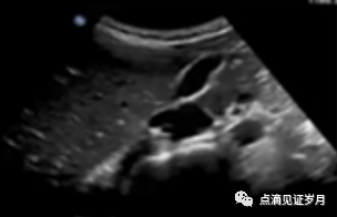 Understanding and Adjusting Parameters of Color Doppler Ultrasound Machines