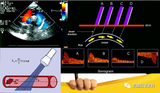 Understanding and Adjusting Parameters of Color Doppler Ultrasound Machines