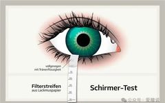 Dry Eye Clinical Examination and Diagnostic Instruments (Part 1)