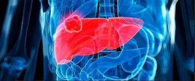 Comprehensive Review of Current Advances in Intrahepatic Cholangiocarcinoma Treatment