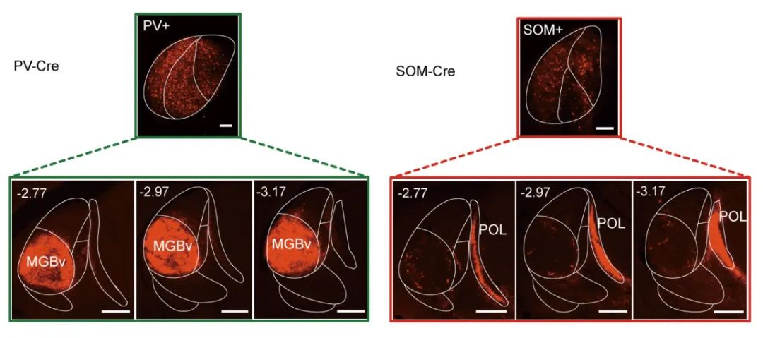 Challenging Traditional Views: Tsinghua Team Redefines Auditory Pathways
