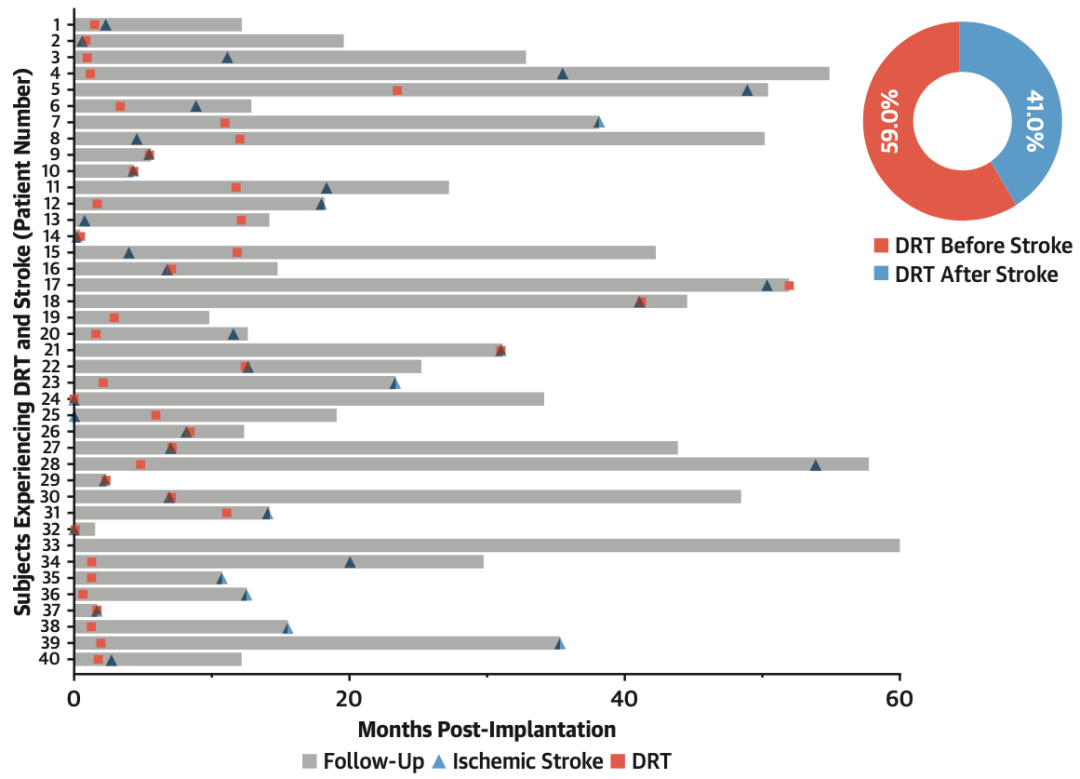 Predictive Factors of DRT After LAAO: International Multicenter Data