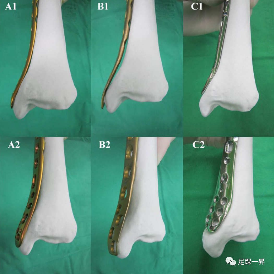 Application of 3D Printing Technology in Complex Tibial Fractures