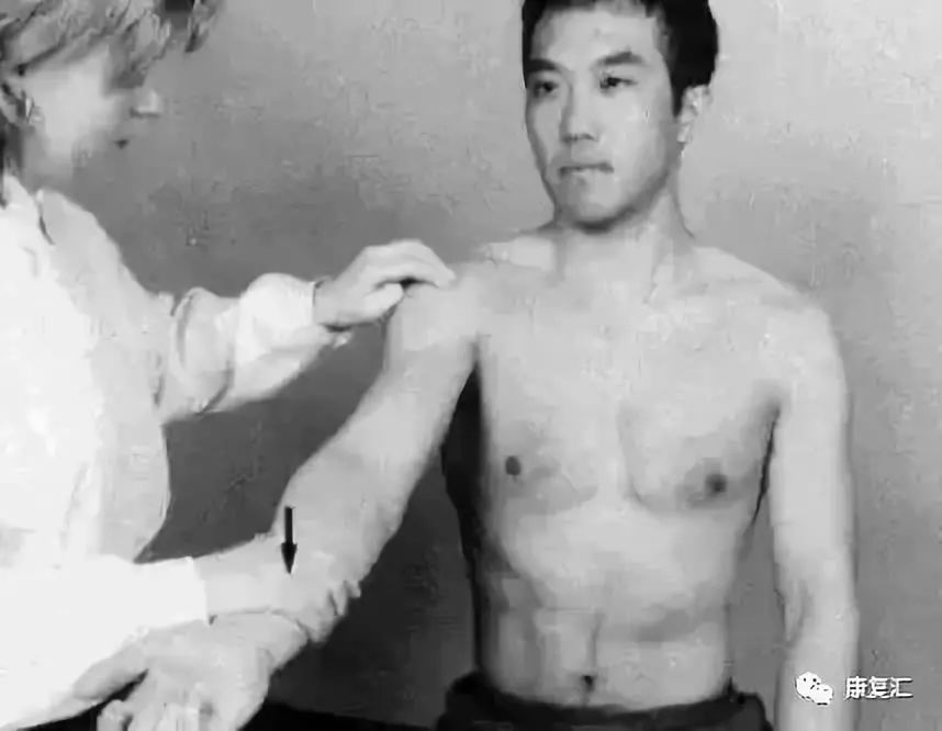 Detailed Guide to Shoulder Joint Physical Examination for Rehabilitation