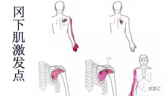 Detailed Guide to Shoulder Joint Physical Examination for Rehabilitation