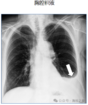 Compilation of Chest Imaging Terminology (IV)