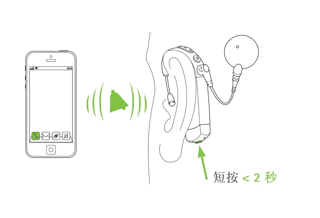 Comprehensive Analysis of Naida CI Connect Wireless Listening Accessories