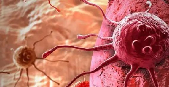 Comprehensive Review of Current Advances in Intrahepatic Cholangiocarcinoma Treatment
