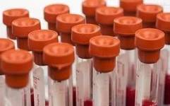 Significance and Normal Values of C-Peptide Release Test