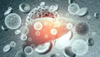 Comprehensive Review of Current Advances in Intrahepatic Cholangiocarcinoma Treatment