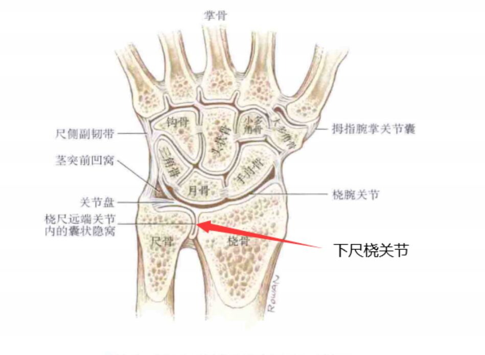 Common Factors for Ulnar-Sided Wrist Pain in Athletes