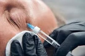 Understanding Blepharospasm and Apraxia of Eyelid Opening in PSP Patients