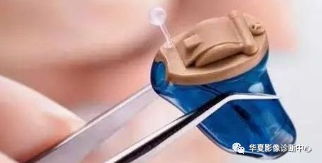 Understanding Medical 3D Printing and Its Applications