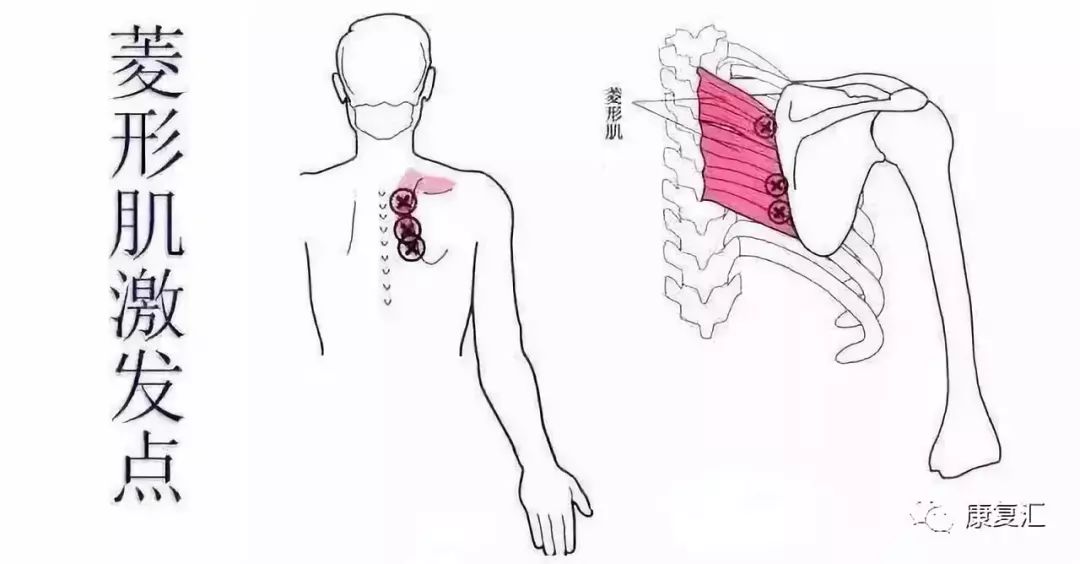 Detailed Guide to Shoulder Joint Physical Examination for Rehabilitation