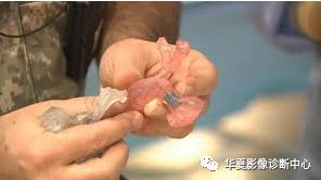 Understanding Medical 3D Printing and Its Applications
