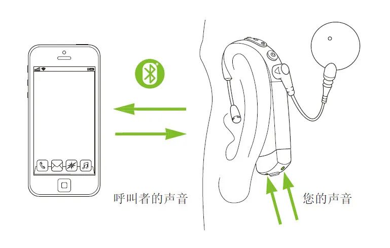 Comprehensive Analysis of Naida CI Connect Wireless Listening Accessories