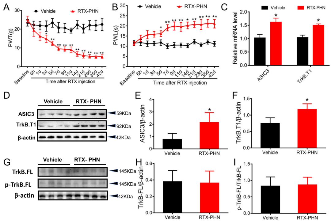Inhibiting BDNF/TrkB.T1 Receptor Alleviates Postherpetic Neuralgia