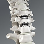Overview of Global Orthopedic Robot Products and Technologies