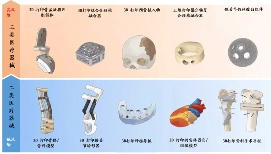 Additive Manufacturing Technology: Analysis and Outlook of Metal 3D Printing