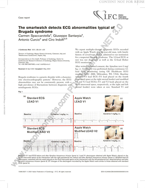 Mastering Smartwatches: Transforming Into An ECG Machine
