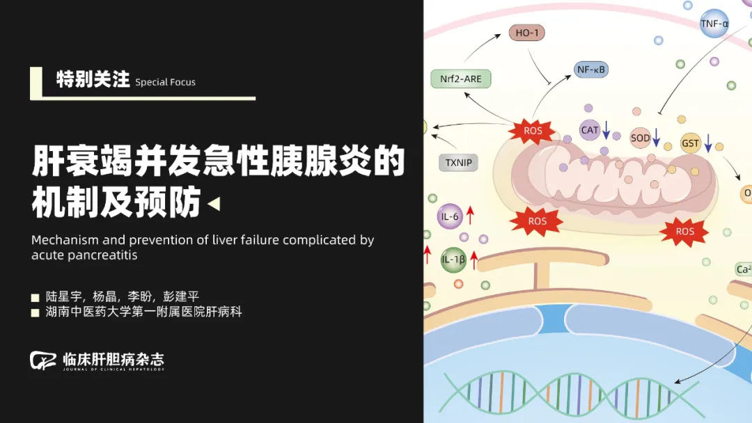 Mechanisms and Prevention of Acute Pancreatitis Complicating Liver Failure