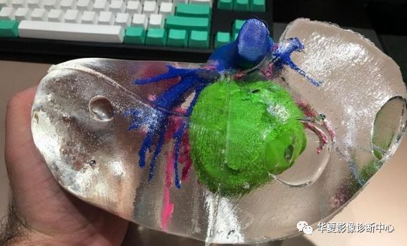 Understanding Medical 3D Printing and Its Applications