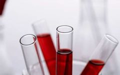 What To Do If Your High-Sensitivity C-Reactive Protein Is Elevated?