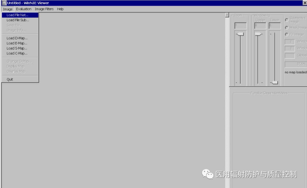 Siemens DR Preprocessing Image Retrieval (Part 1)
