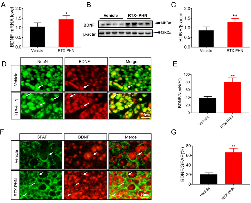 Inhibiting BDNF/TrkB.T1 Receptor Alleviates Postherpetic Neuralgia