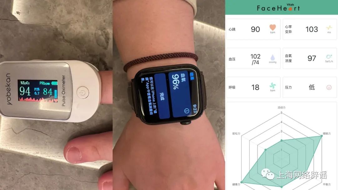 Differences Between Smartwatch and Pulse Oximeter Monitoring Results