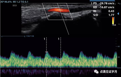 Understanding and Adjusting Parameters of Color Doppler Ultrasound Machines