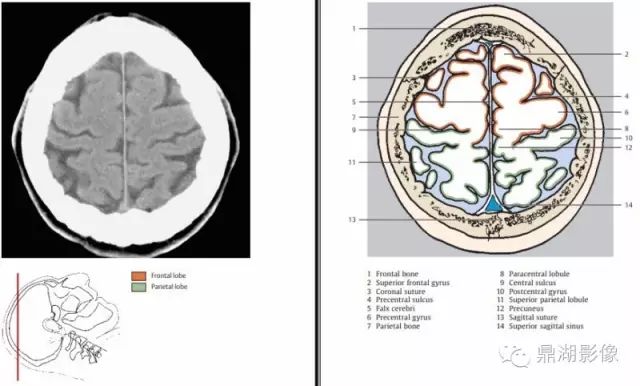 The Most Comprehensive CT Cross-Sectional Anatomy Atlas