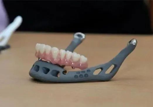 Revealing the Secrets of 3D Printing Technology in Dentistry