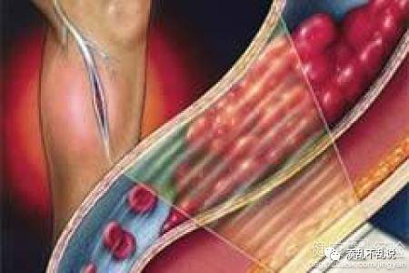 Understanding Protein C, Anti-Protein C Antibodies, CRP, Immunoglobulins, and Albumin