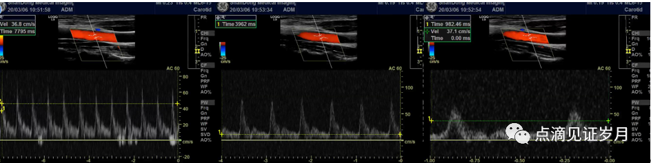 Understanding and Adjusting Parameters of Color Doppler Ultrasound Machines