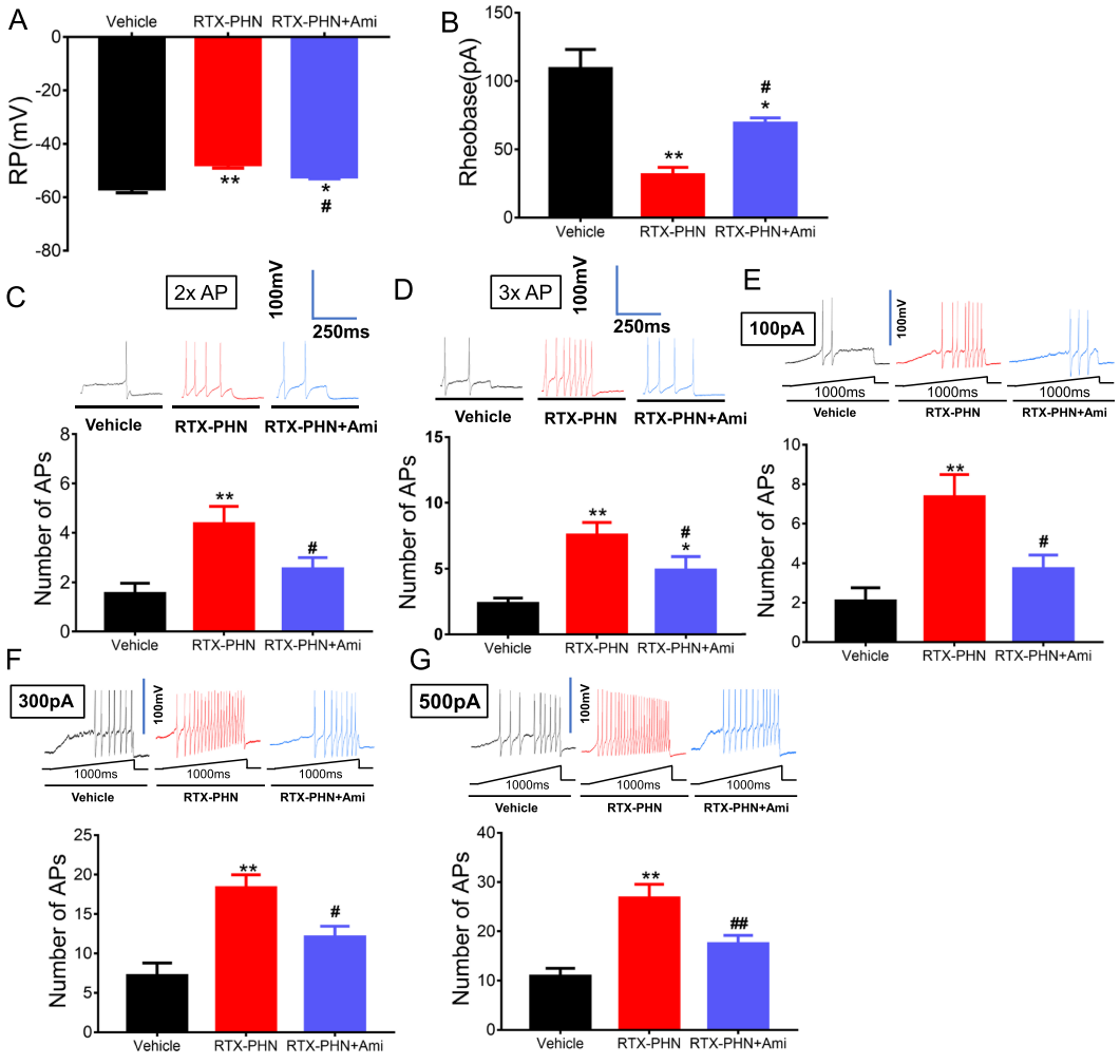 Inhibiting BDNF/TrkB.T1 Receptor Alleviates Postherpetic Neuralgia