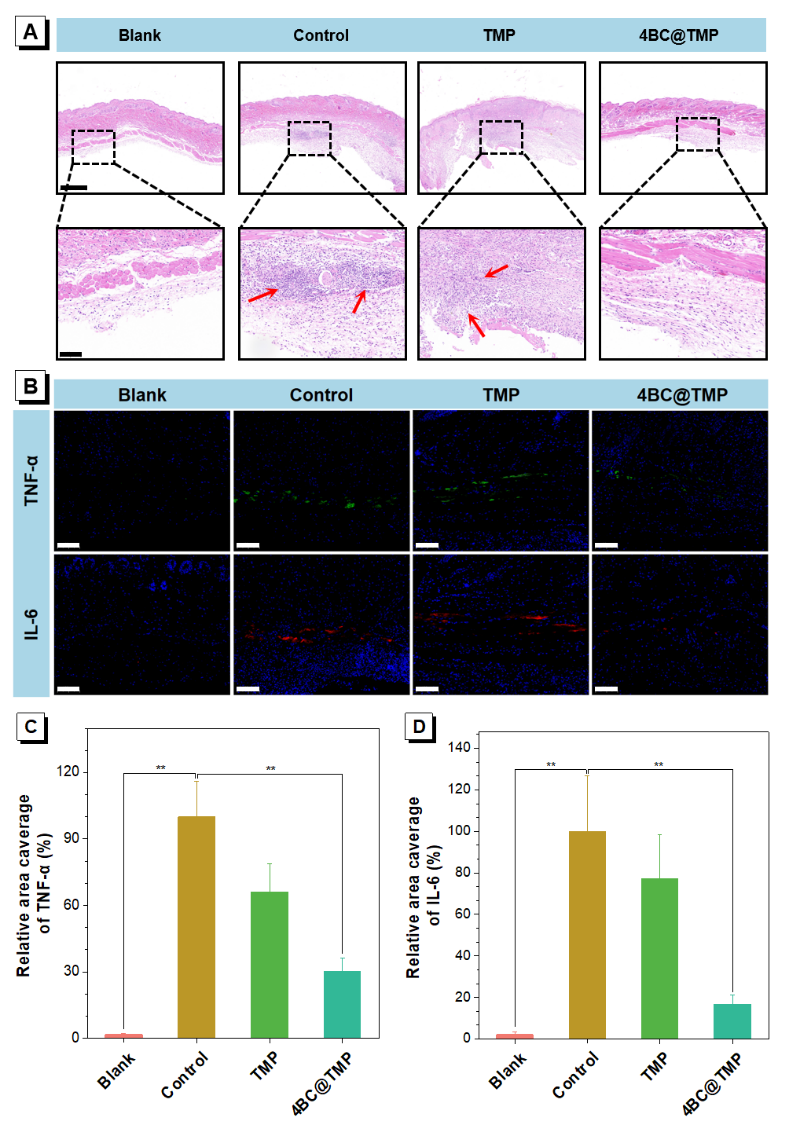 AIE-Enabled 3D Printed Scaffolds for In Situ Imaging and Anti-Inflammatory Function