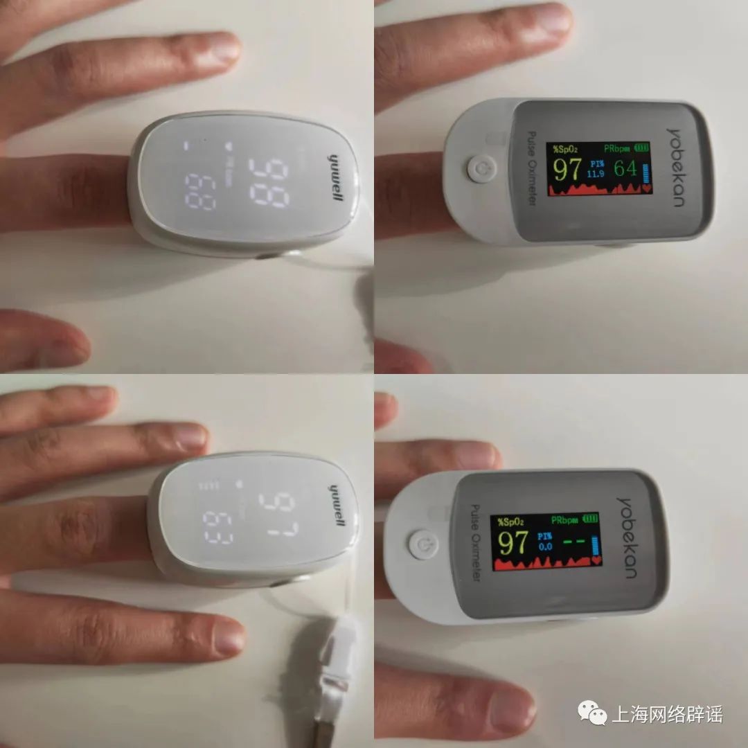 Differences Between Smartwatch and Pulse Oximeter Monitoring Results