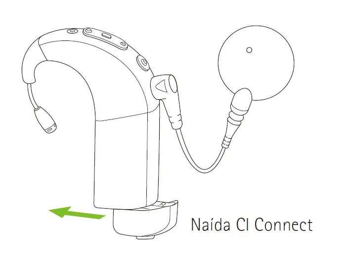 Comprehensive Analysis of Naida CI Connect Wireless Listening Accessories