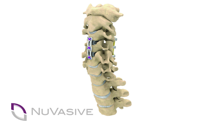 Overview of Global Orthopedic Robot Products and Technologies