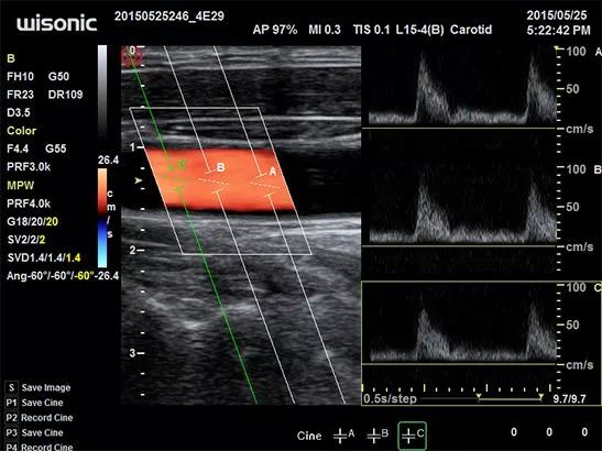 A Must-Read Guide to Ultrasonic Diagnostic Equipment