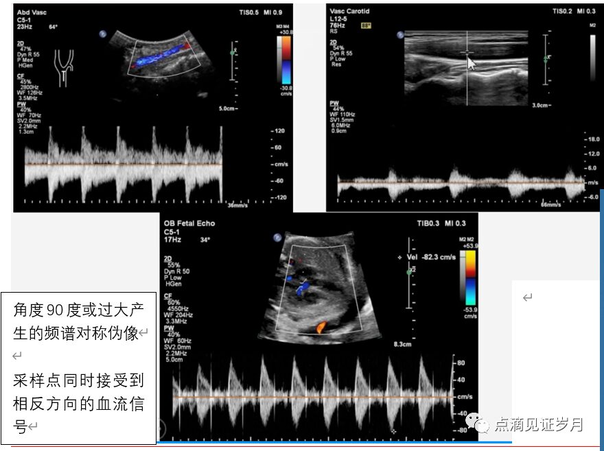 Understanding and Adjusting Parameters of Color Doppler Ultrasound Machines