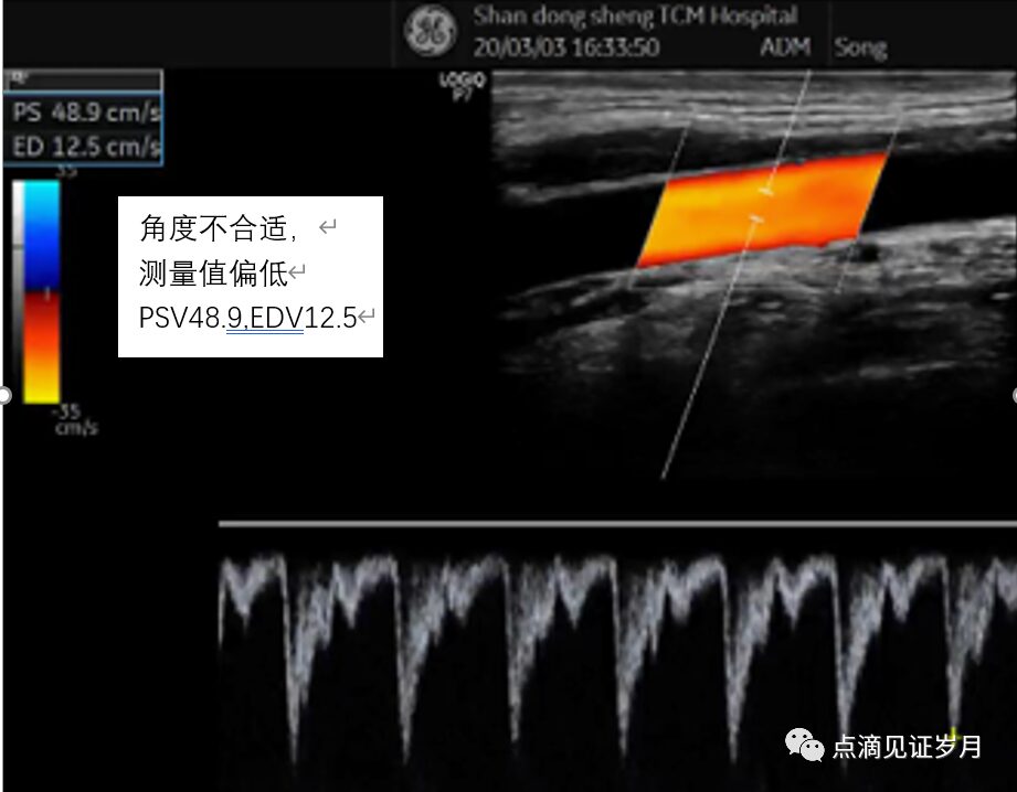 Understanding and Adjusting Parameters of Color Doppler Ultrasound Machines