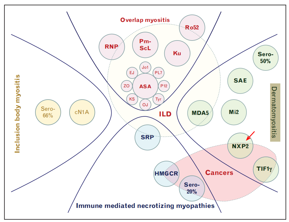 Understanding NXP2 Positive Juvenile Dermatomyositis