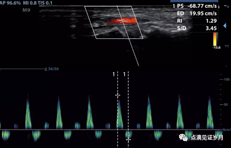Understanding and Adjusting Parameters of Color Doppler Ultrasound Machines