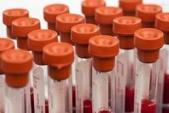 Significance and Normal Values of C-Peptide Release Test