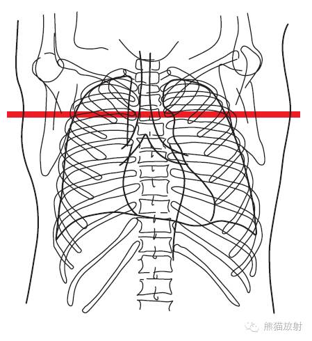 Chest Anatomy | Chest CT Cross-Sectional Anatomy