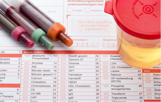 Cystatin C (CYS-C) | A Sensitive Indicator of Glomerular Filtration Rate