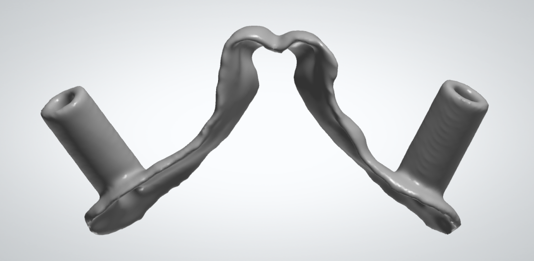 3D Printing Bones: Turning Virtual into Reality