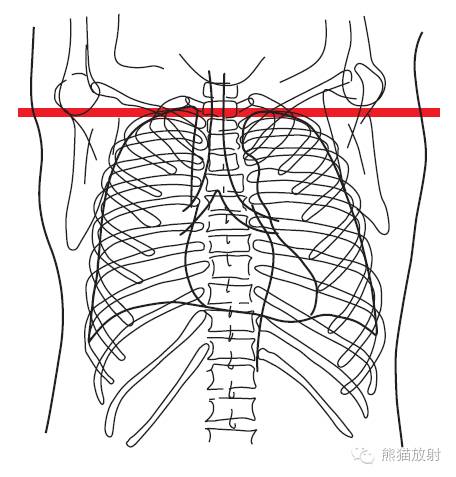 Chest Anatomy | Chest CT Cross-Sectional Anatomy